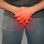 Genital-Herpes