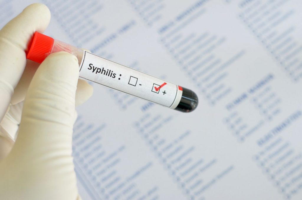 Syphilis...