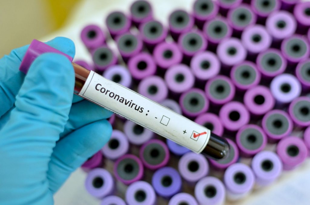 Das neuartige Coronavirus...